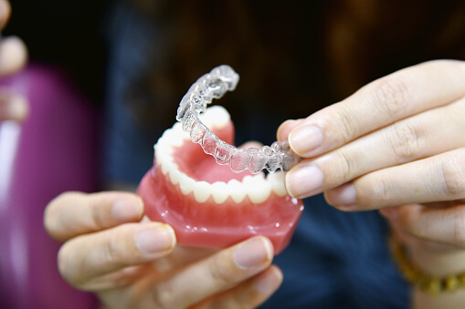 Dentist demonstrating how Invisalign aligners fit onto teeth using plastic teeth