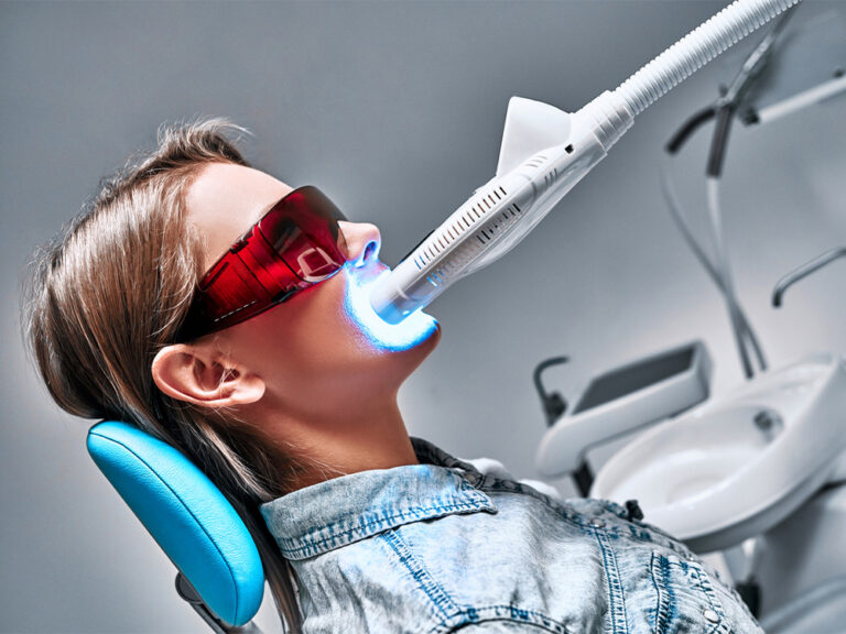 Woman in dentist office chair receiving an ultra violet light assisted teeth whitening treatment