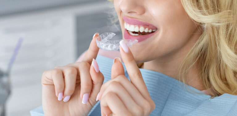 smiling women inserting Invisalign clear aligners to the top row of her teeth